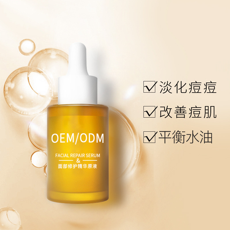 迪庆藏族自治州_祛痘精华原液OEM